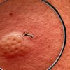 Den Oropouche-Virus fuerdert seng éischt Doudesaffer | © picture alliance / CHROMORANGE | Michael Bihlmayer